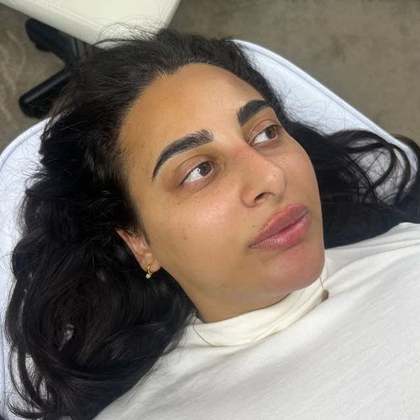 Natural lip result