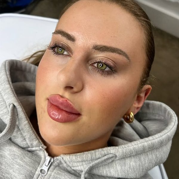 Lip enhancement result