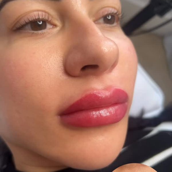Lip blush result